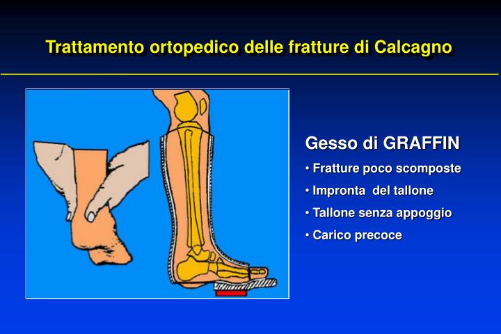 Che il fungo di unghie che sopportano piaceri