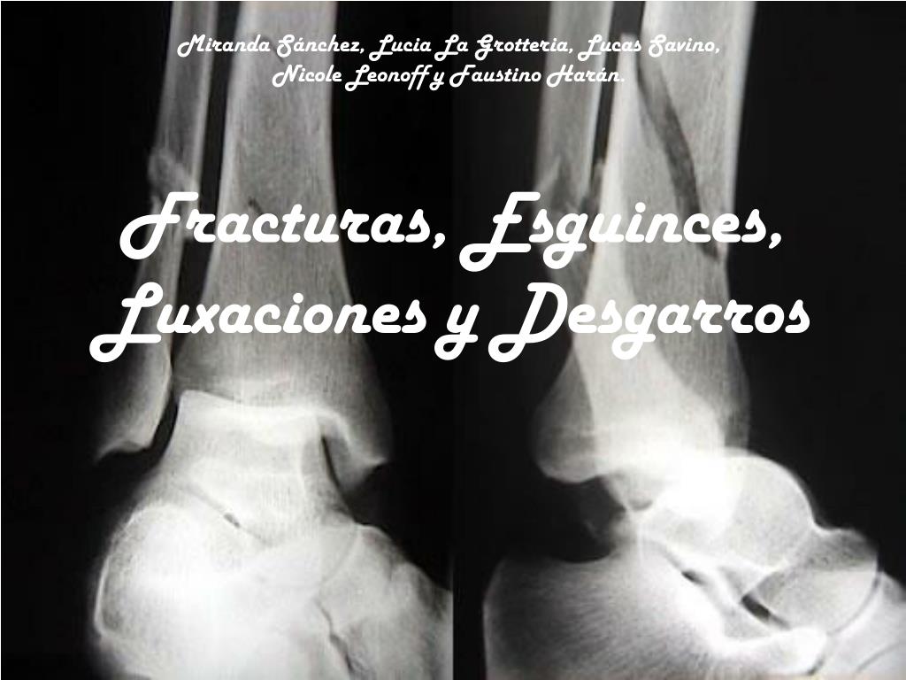 Ppt Fracturas Esguinces Luxaciones Y Desgarros Powerpoint