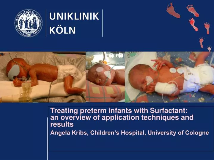 PPT Treating preterm infants with Surfactant an