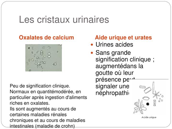 Presence De Cristaux Oxalate De Calcium Dans Les Urines PPT - Exploration de la fonction rénale PowerPoint Presentation - ID