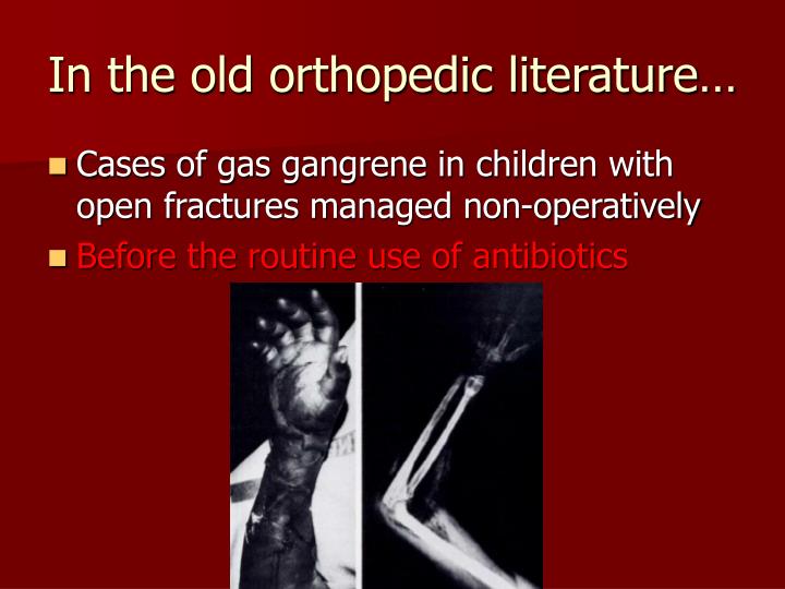 literature review open fracture