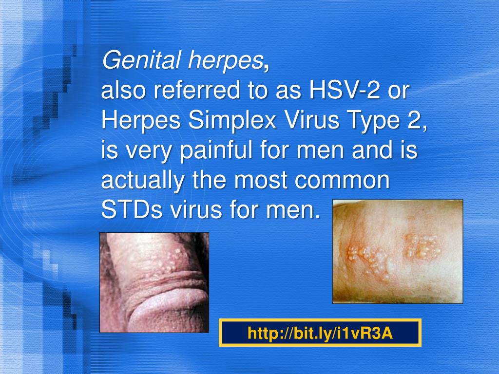 Dating with type 1 genital herpes