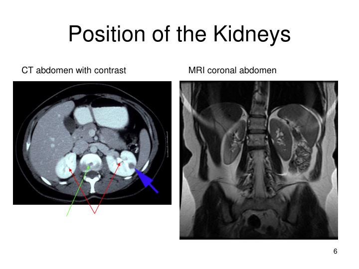 PPT - Urinary System- Anatomy and Physiology PowerPoint Presentation
