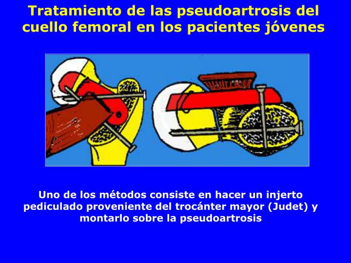 De gelatina la máscara a los cabellos