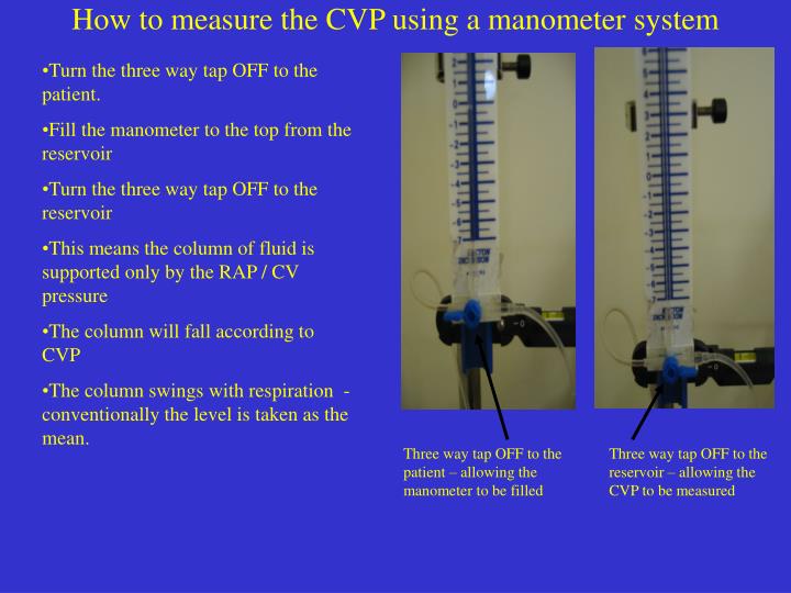 PPT Central Venous Pressure and Central lines PowerPoint Presentation