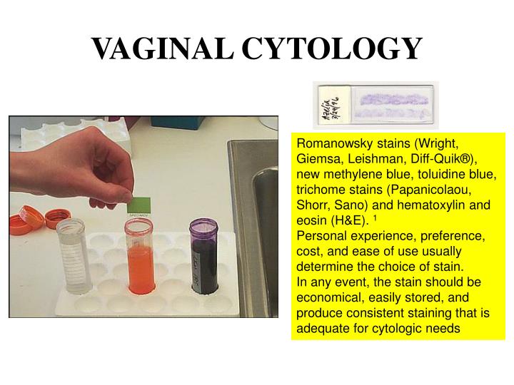 Penis visulizer comparison Anal fucked without lube