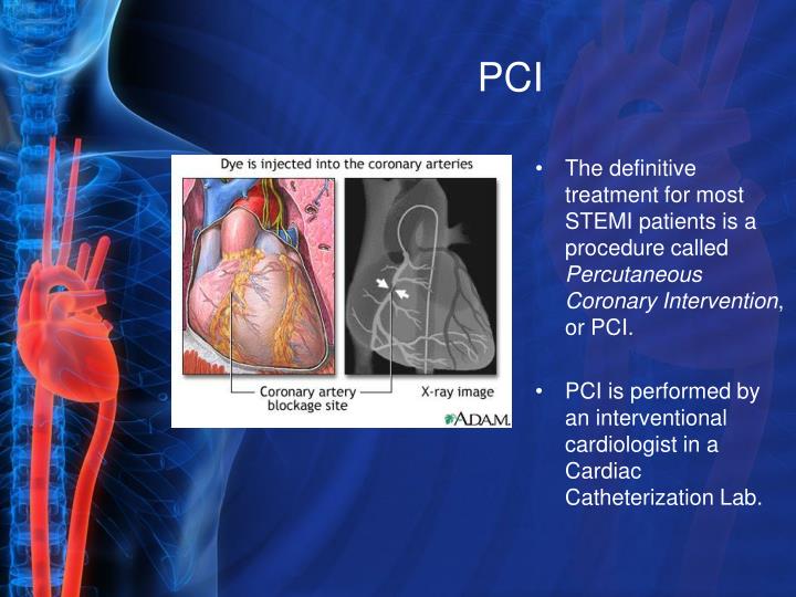 cardiac cath guideliner