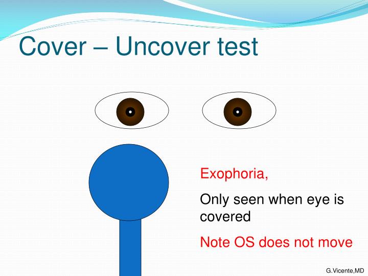 PPT Strabismus for 5 th yr medical students PowerPoint