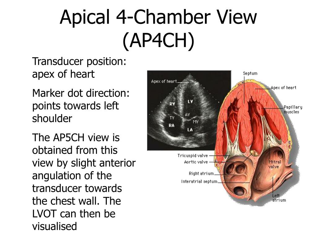 PPT - Introduction to Echocardiography Cardiac Ultrasound ...