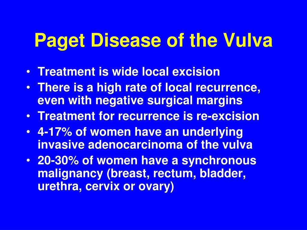 PPT Vulvar Cancer PowerPoint Presentation ID227179