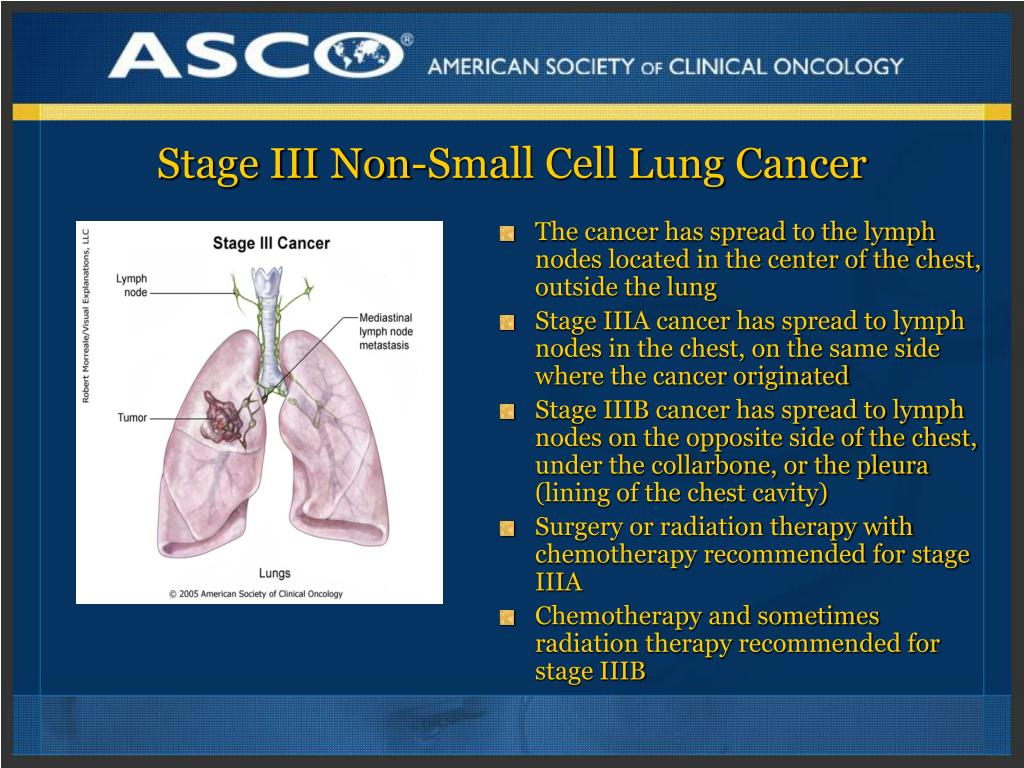Stage 3 non small cell lung cancer prognosis