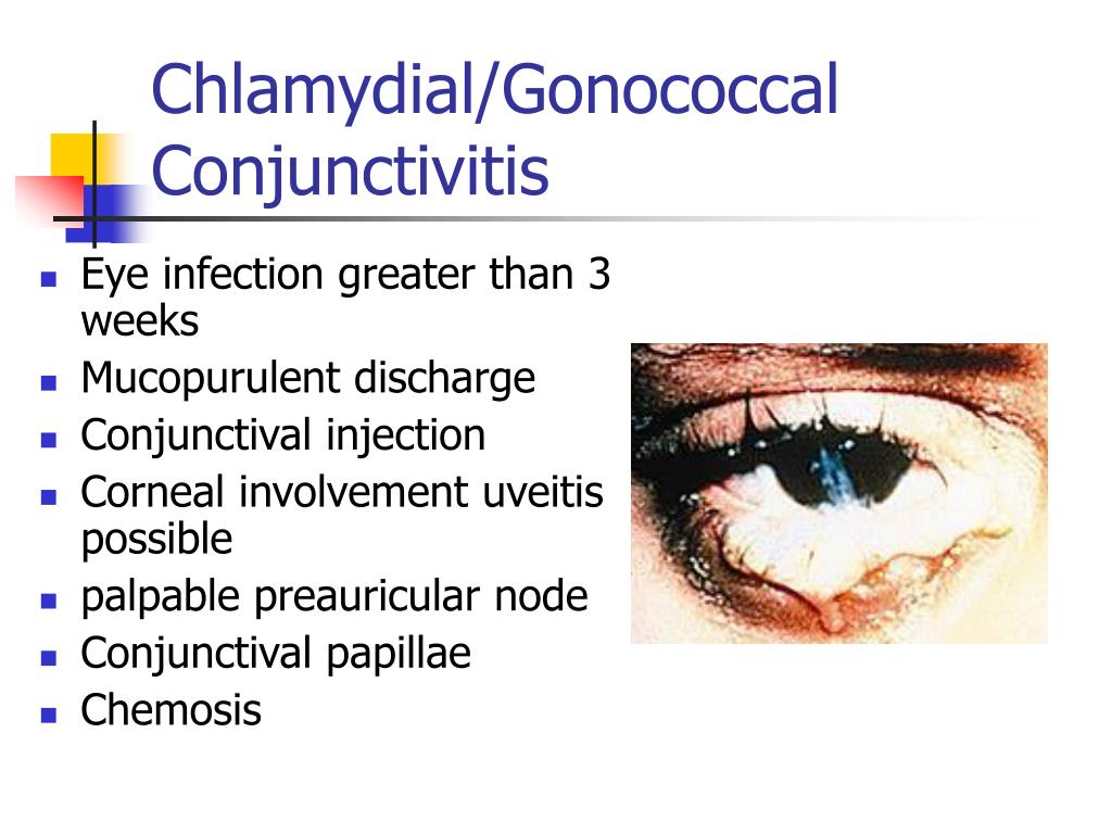clamidia and gonorrhea symptoms clamidia and gonorrhea symptoms