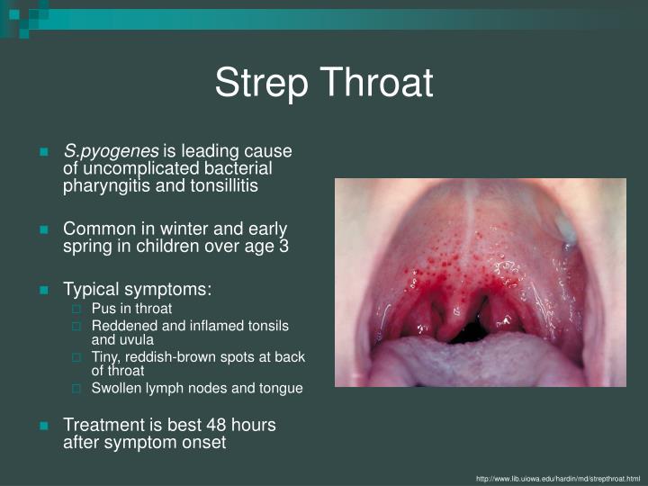 Symptoms And Symptoms Of Antibiotics And Streptococcus