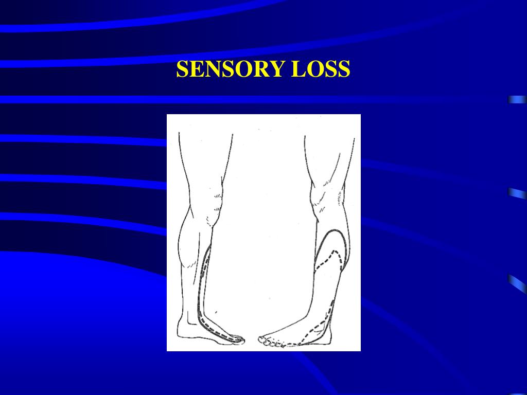 Nvq2 sensory loss