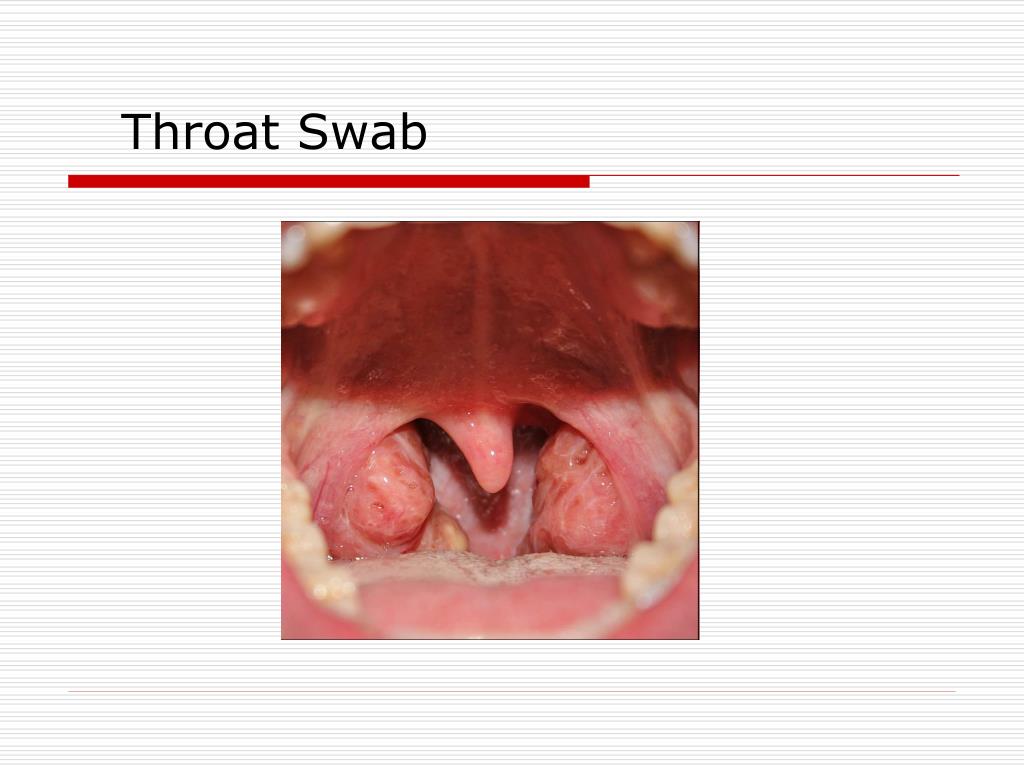 How To Do A Throat Swab 24