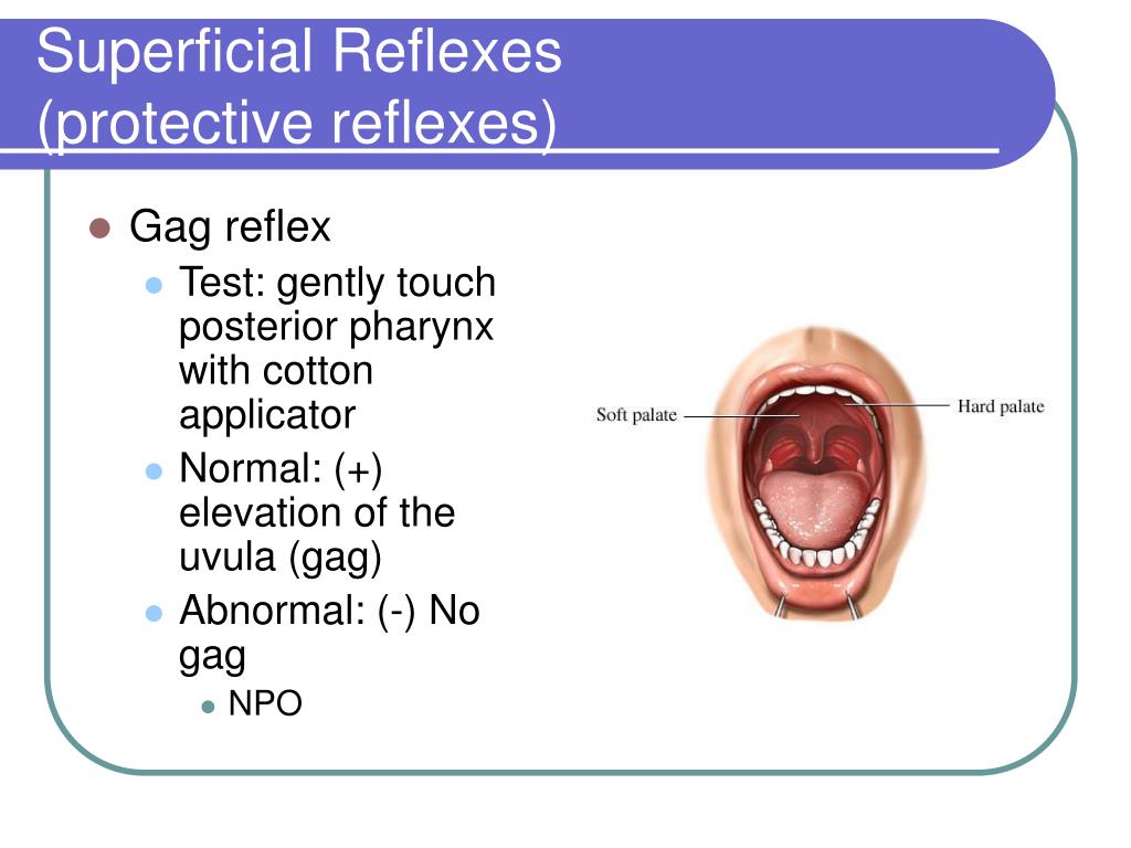 Testing Teen Gag Reflex Deepthroat Porn Teen Tests Out Her Gag Reflex