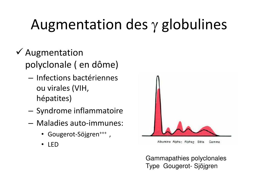 Aspect De Restriction D'hétérogénéité Des Gamma Globulines PPT - Interprétation de l’électrophorèse des protéines sériques
