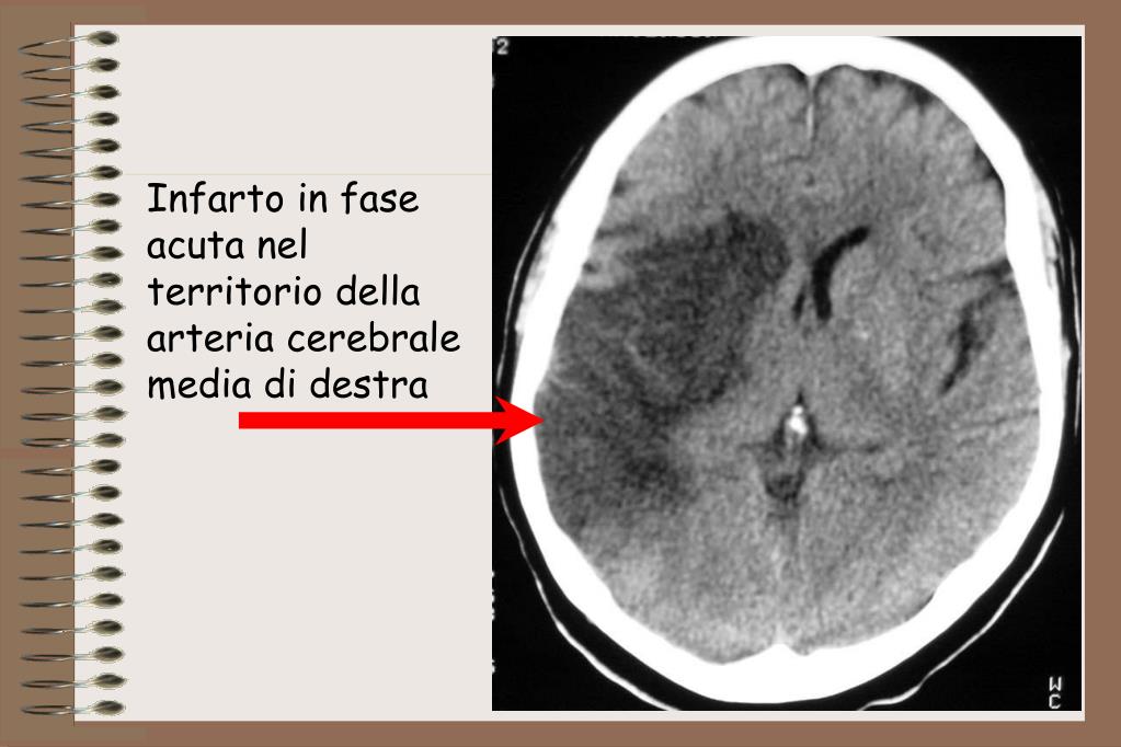 Lo stoccaggio per donne incinte contro varicosity