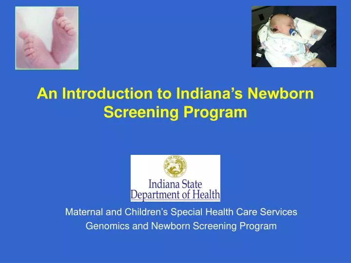 newborn screening program newborn screening program
