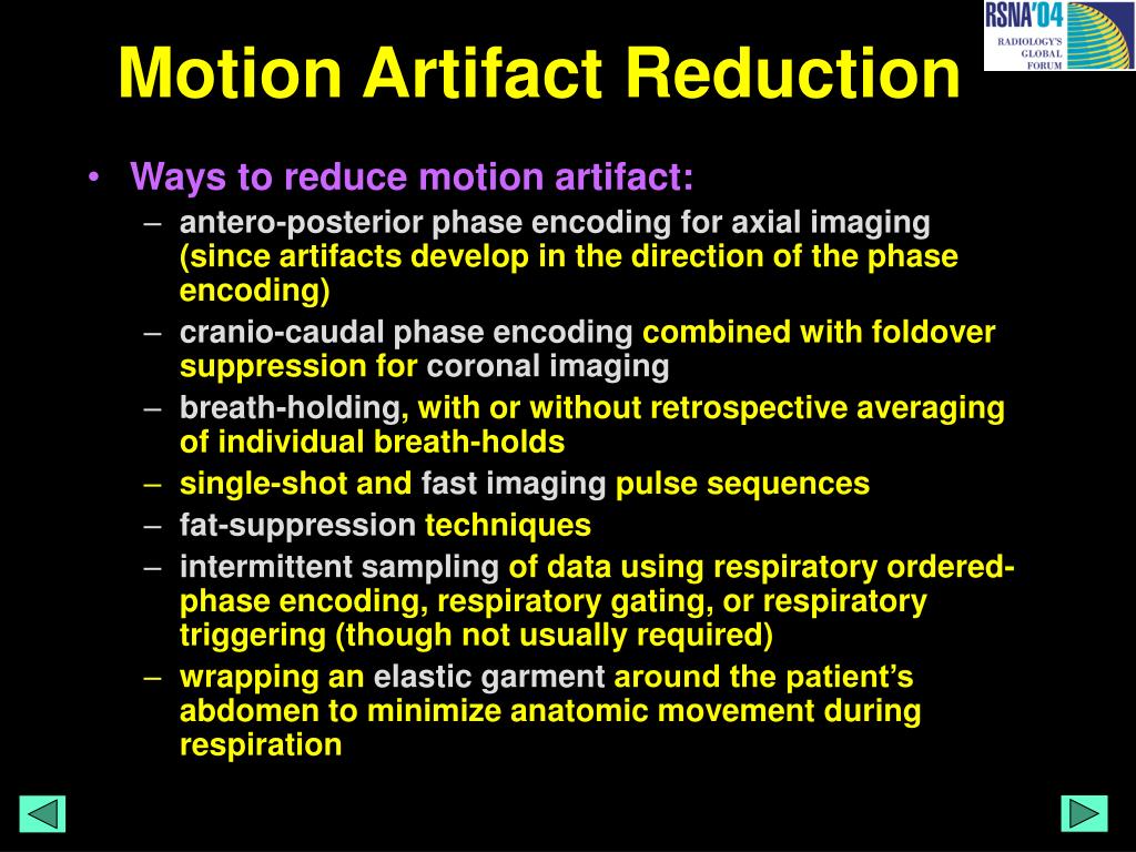 motion artifact meaning motion artifact meaning