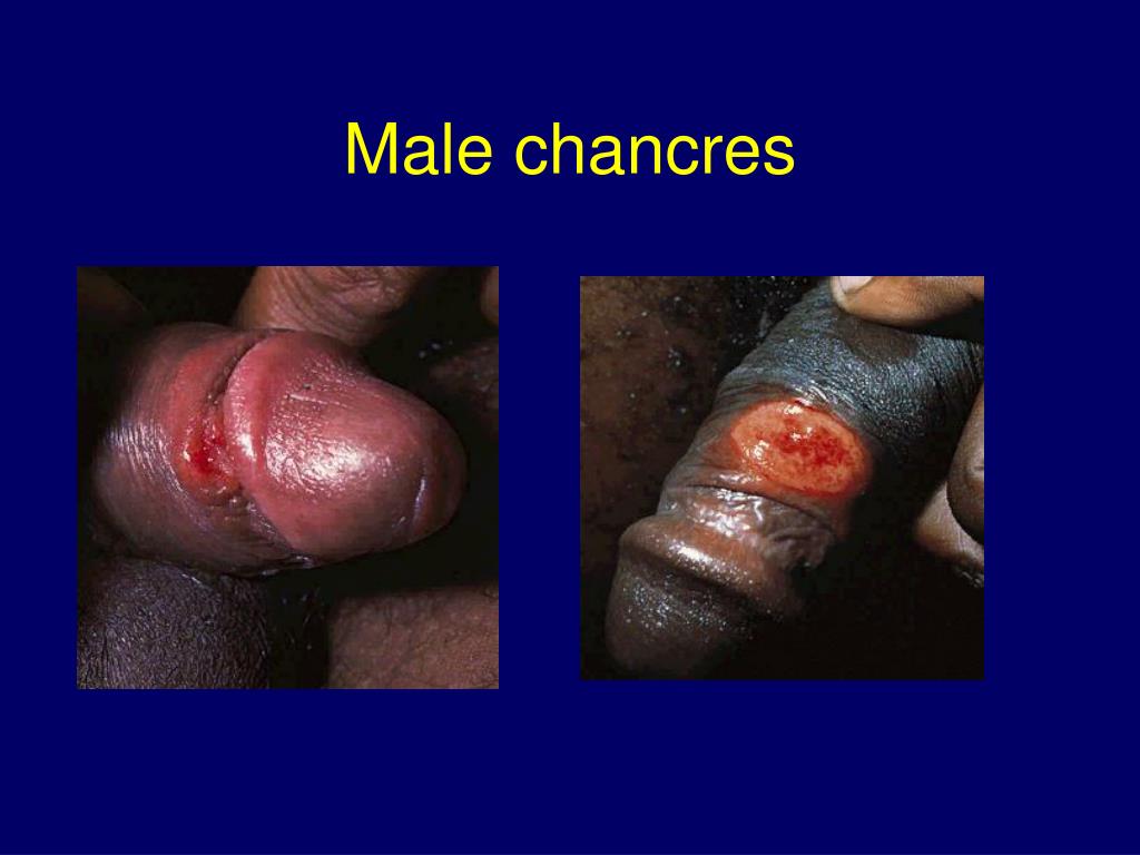 oral sex and sexually transmitted diseases mom milks dick of cum