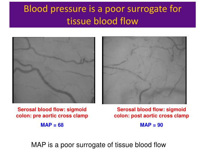 Long term regulation of blood pressure