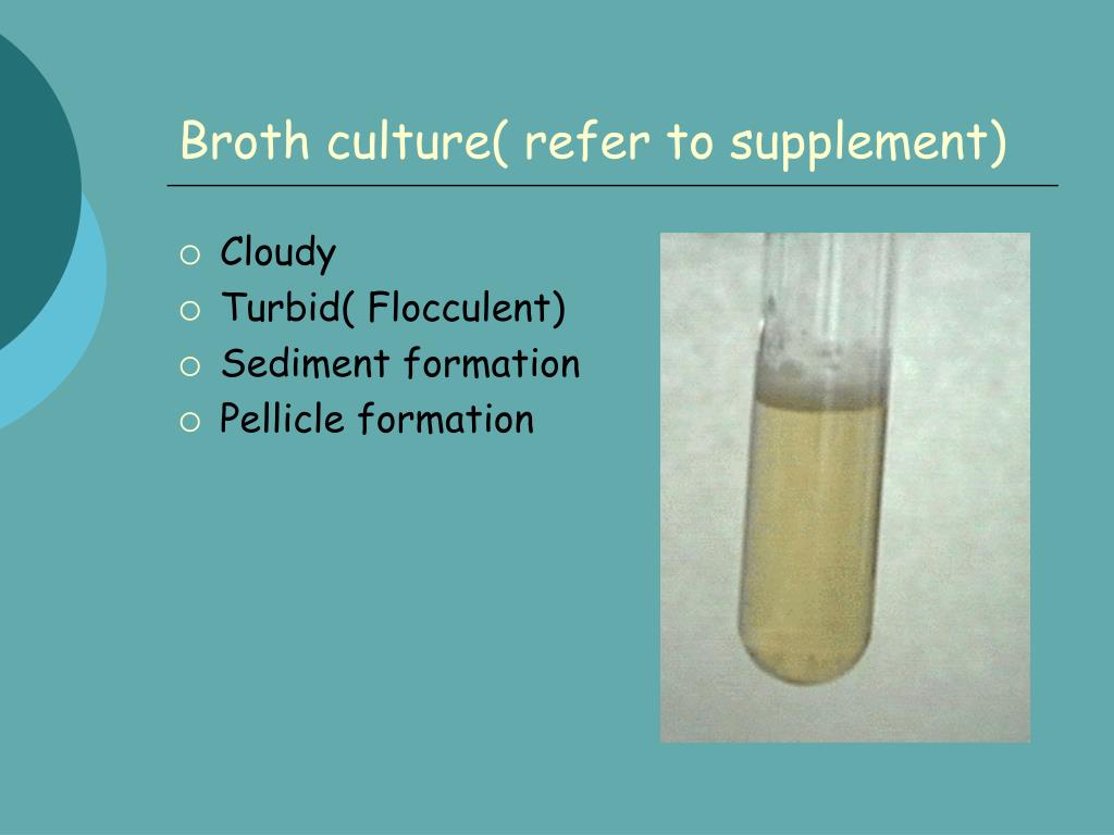 PPT Microbiology PowerPoint Presentation ID 394963 ppt-microbiology-powerpoint-presentation-id-394963