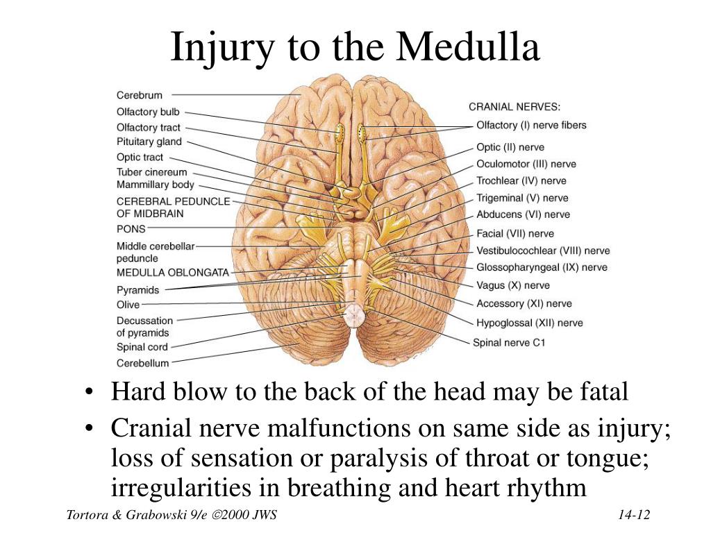 PPT Chapter 14 The Brain And Cranial Nerves PowerPoint Presentation 