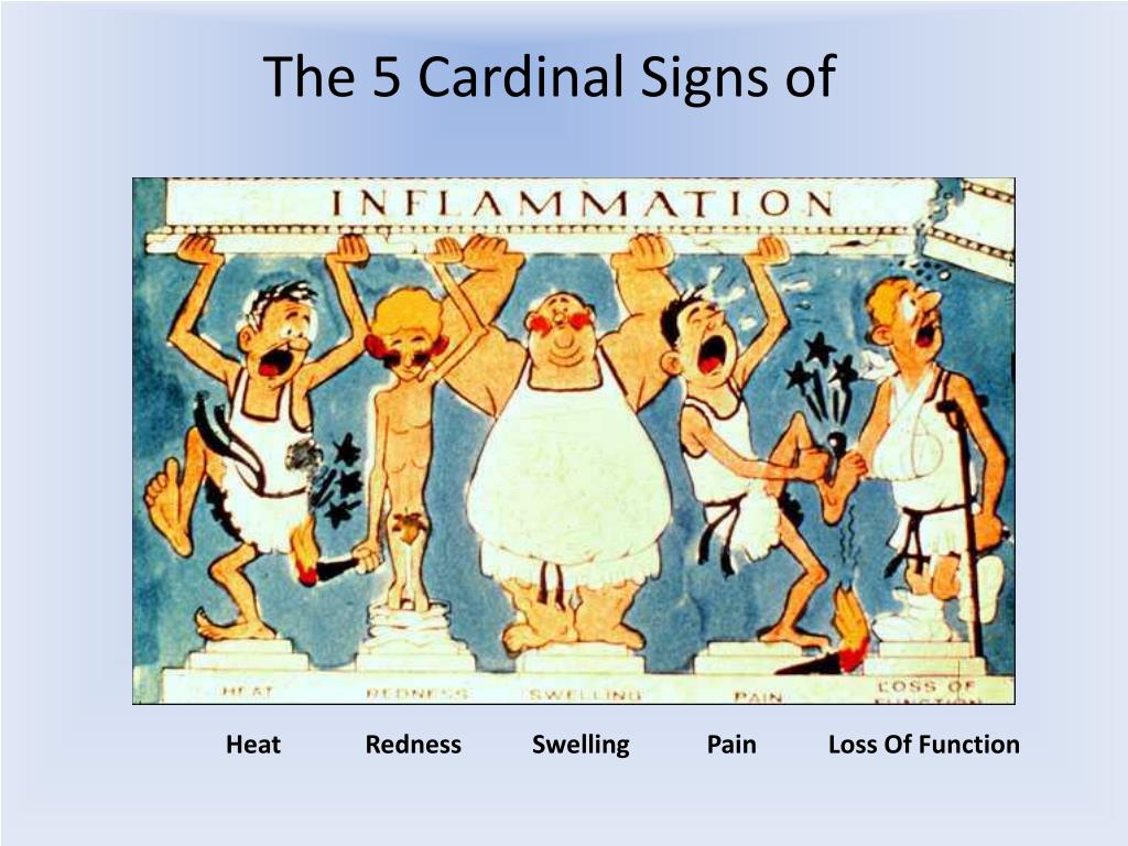 cardinal signs