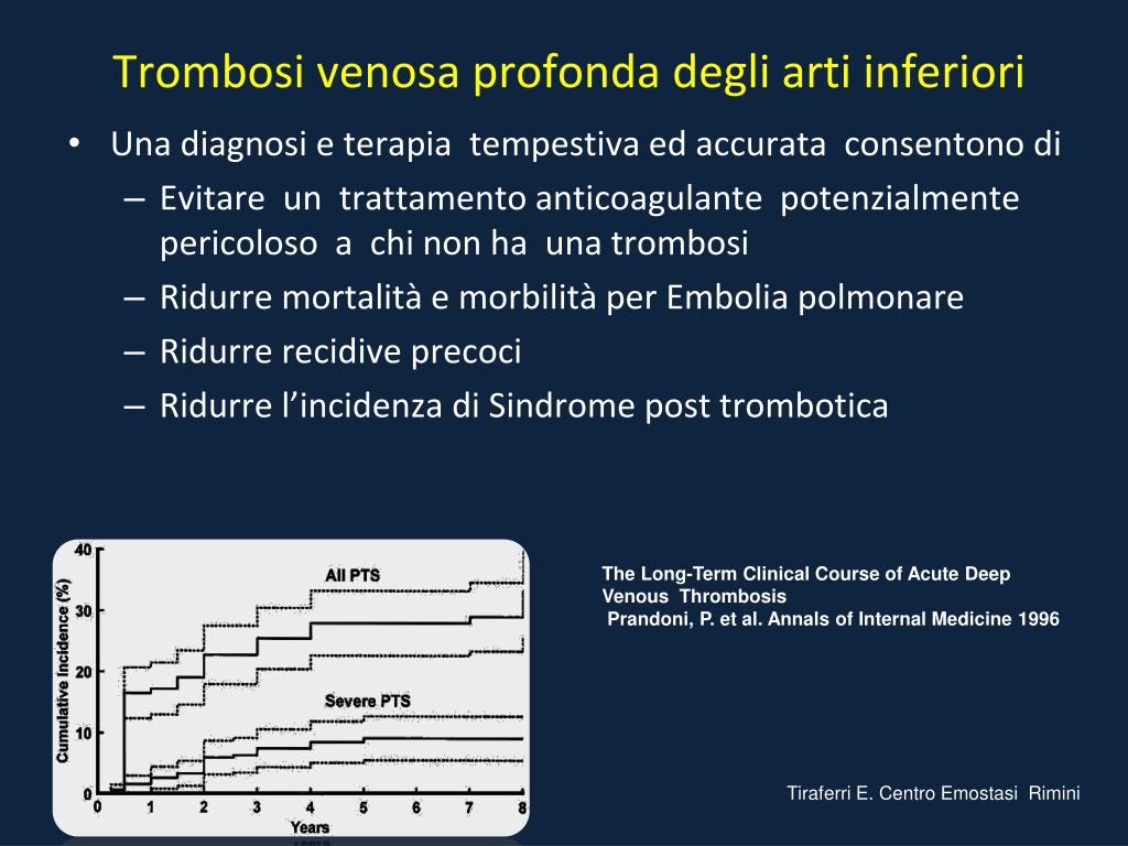 Targhe di prevenzione di vena varicosity