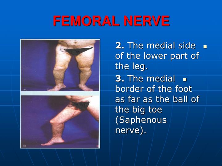 PPT - FEMORAL NERVE INJURY PowerPoint Presentation - ID:472761