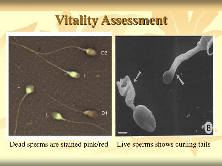 Sperm test vitality above You Sperm test vitality opinion, interesting