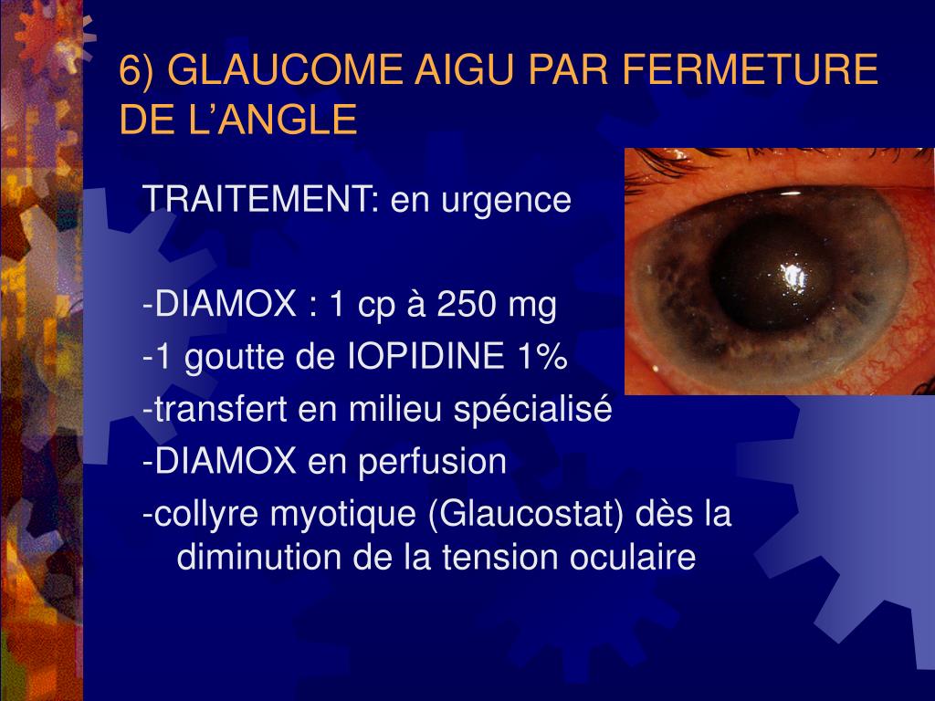 PPT - L’ŒIL ROUGE ET IRRITE DU SUJET AGE PowerPoint PPT - L’ŒIL ROUGE ET IRRITE DU SUJET AGE PowerPoint