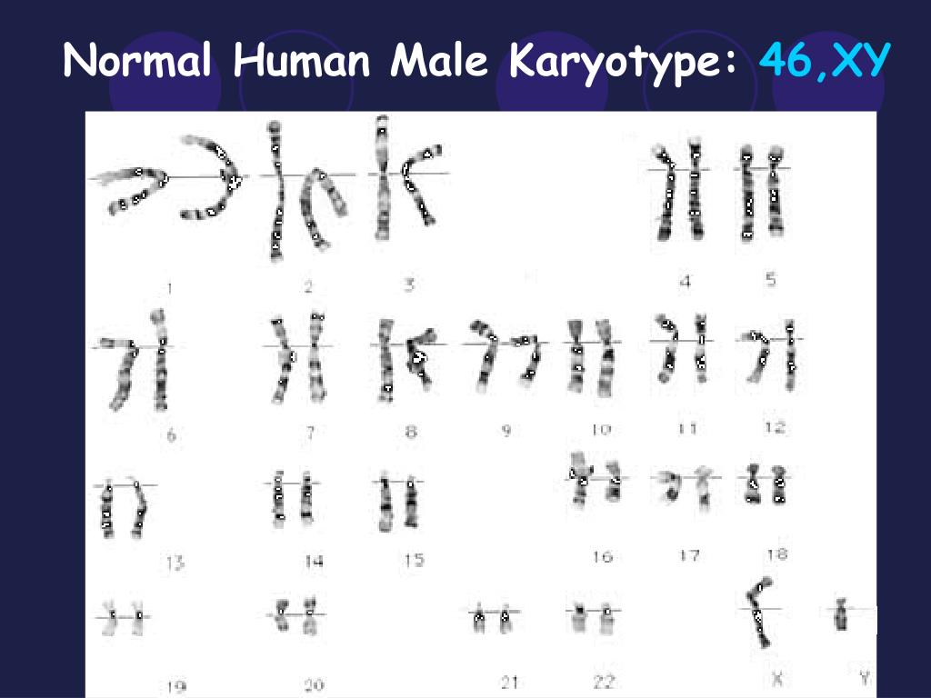 Homologous Chromosomes With Karyotype Normal Pictures to ...