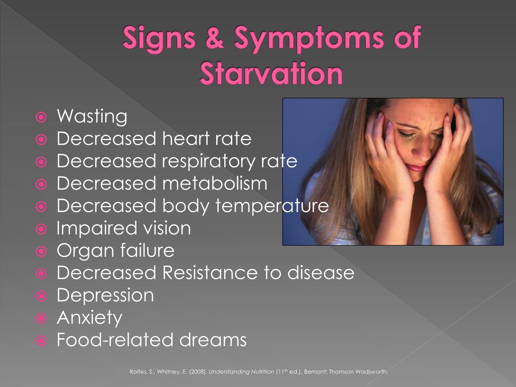 physical symptoms of starvation