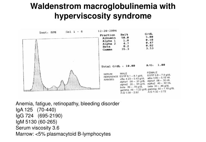 viscosity blood test waldenstrom viscosity blood test waldenstrom