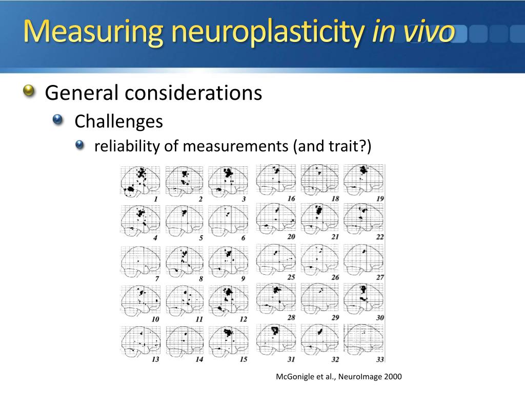 plasticity in humans There is a general consensus that sleep is strictly linked to memory, learning, and, in general, to the mechanisms of neural plasticity, and that this link may. plasticity in humans There is a general consensus that sleep is strictly linked to memory, learning, and, in general, to the mechanisms of neural plasticity, and that this link may.