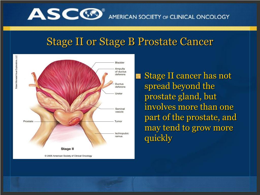 PPT PLWC Slide Deck Series Understanding Prostate Cancer PowerPoint 