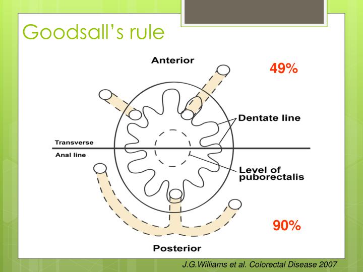 I have a fistula recommendations I have a fistula forecasting