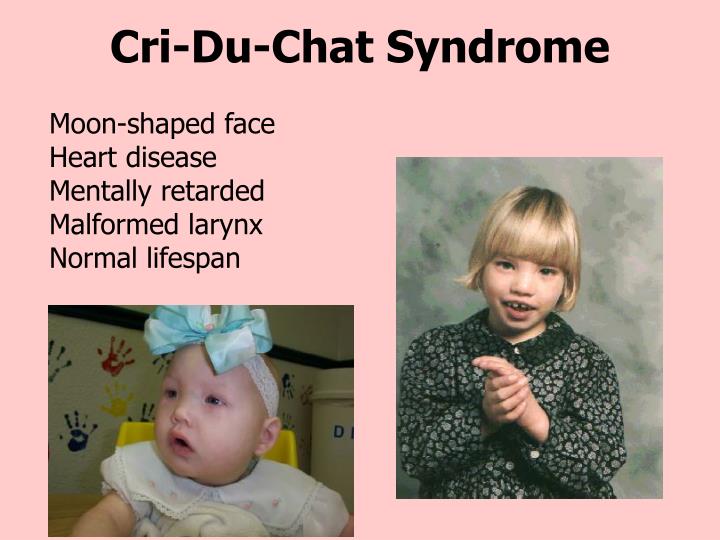what causes cri du chat syndrome