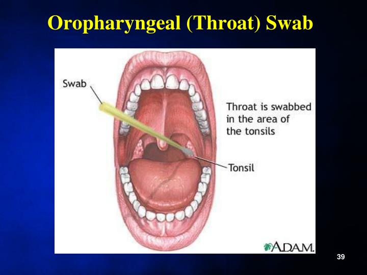 How To Do A Throat Swab 39