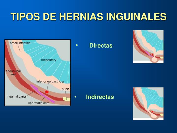 El dolor en los riñones que esto que hacer