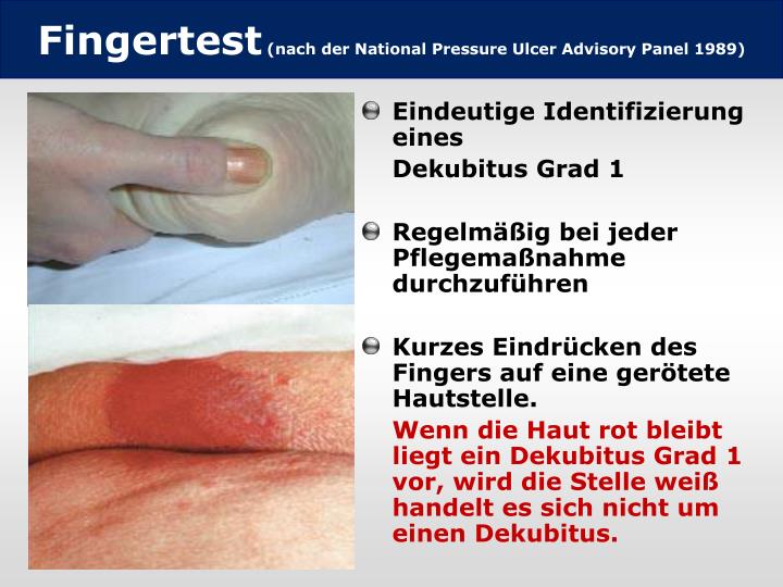 PPT Dekubitus? PowerPoint Presentation ID841736