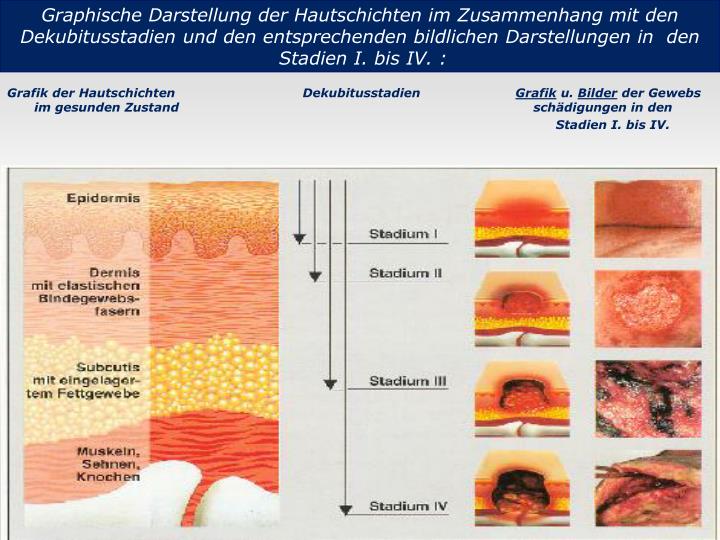 PPT Dekubitus? PowerPoint Presentation ID841736