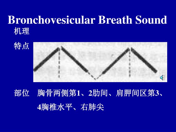 bronchovesicular breath sounds