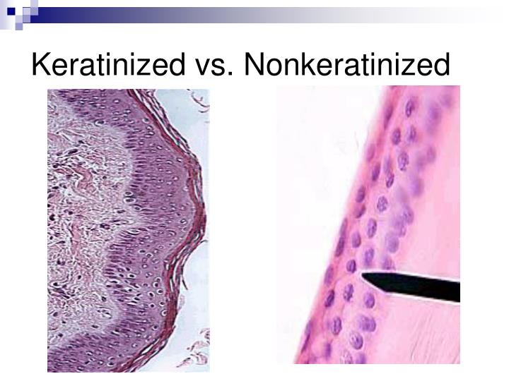 Difference Between Keratinized And Non Keratinized Epithelium PPT - Tissue: Fabric of Life PowerPoint Presentation - ID:853979