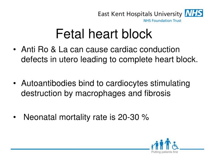 complete heart block case study A third degree av block (complete heart block) is where there is a complete conduction block between the atria and the venticles, which results in no. complete heart block case study A third degree av block (complete heart block) is where there is a complete conduction block between the atria and the venticles, which results in no.