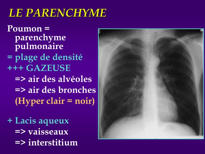Que Veut Dire Absence De Lésion Pleuro-parenchymateuse PPT - EIA de Pneumologie PowerPoint Presentation - ID:914372