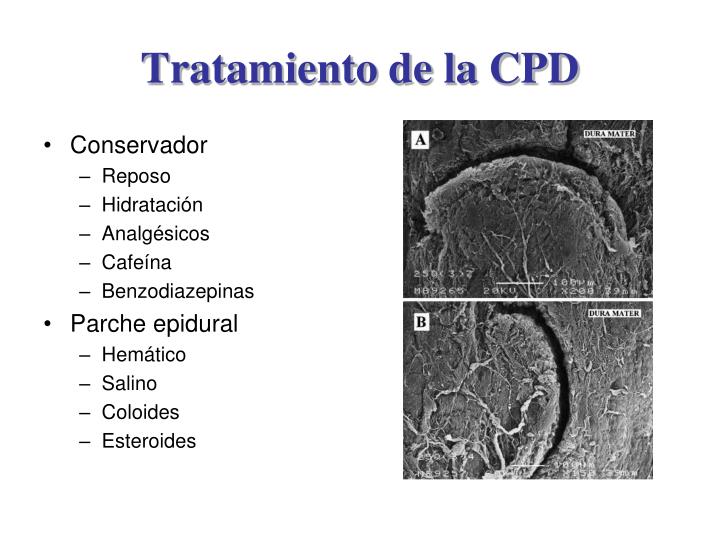 Ivermectin paste side effects in humans Ivermectin paste side effects in humans