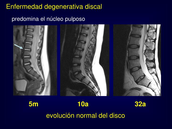 El dolor en el cuello a la izquierda y la hormiguita